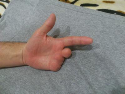 post-33448-0-24978300-1479576869_thumb.jpg